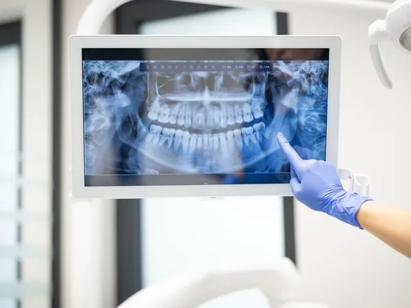 Digital X-ray imaging